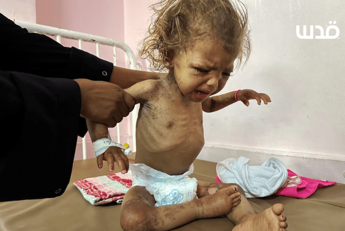 Israel continues to commit horrific massacres in Gaza. (Photo: via QNN)